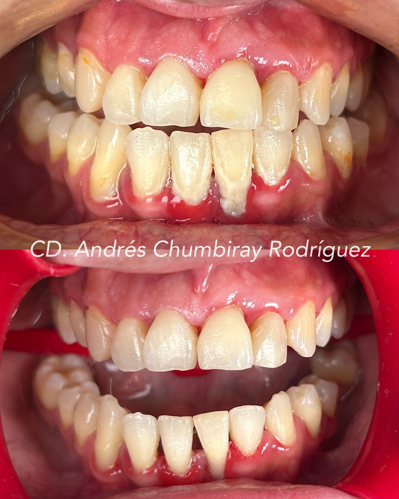 Andrés Chumbiray Rodríguez-2