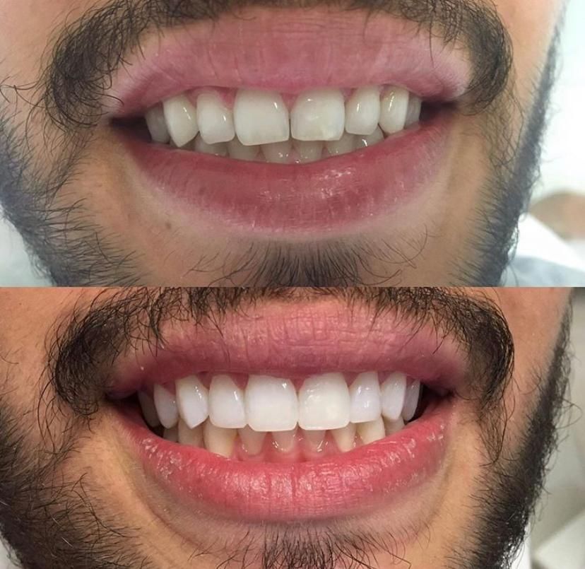 Nayara Fraga De Miranda-26