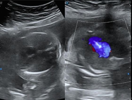 Lady Tatiana Duarte Lopez-16