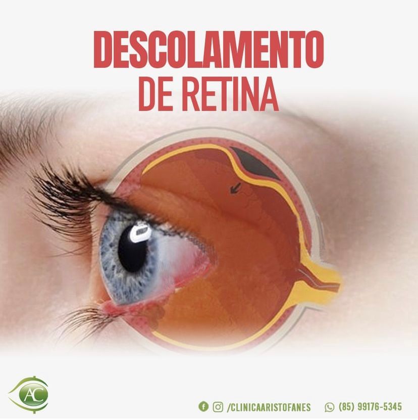 Aristófanes Canamary Jr.-11