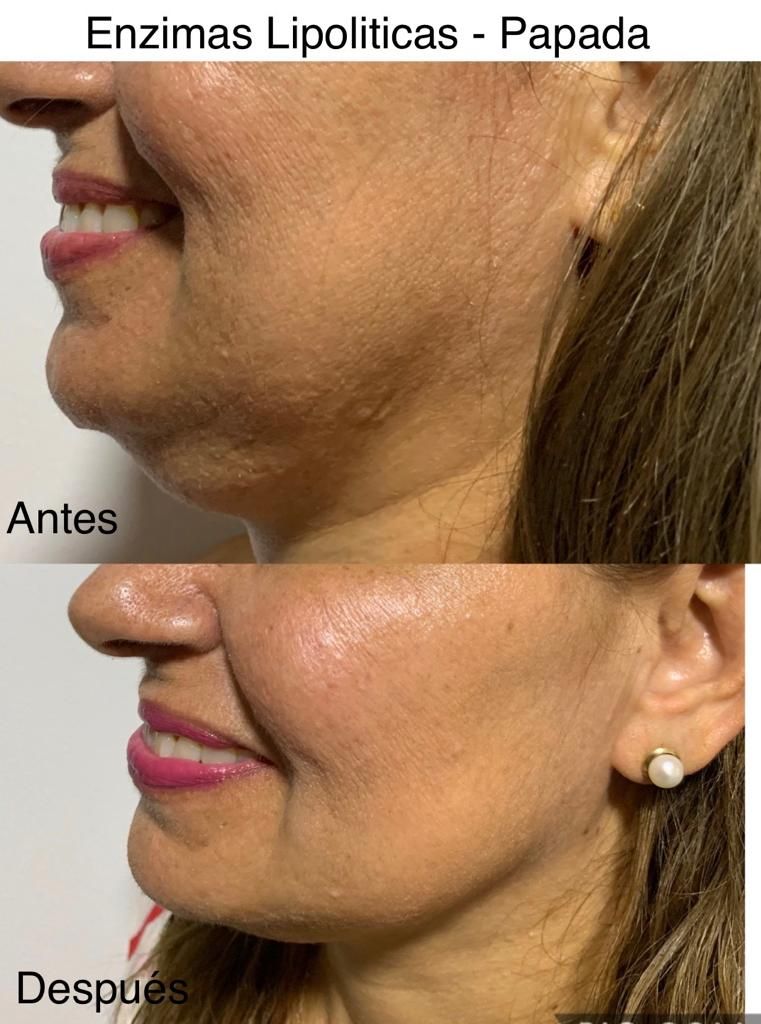 Maria Gisela Angel Losada-81