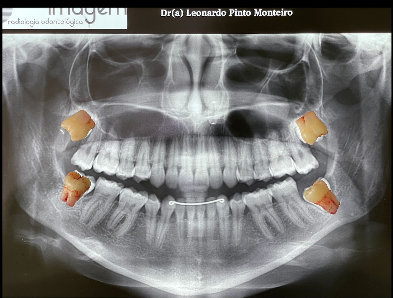 Leonardo Monteiro-17