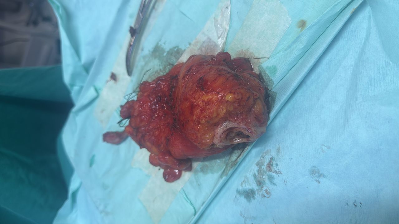 Alexander Alonso Lázaro Chumbe-22