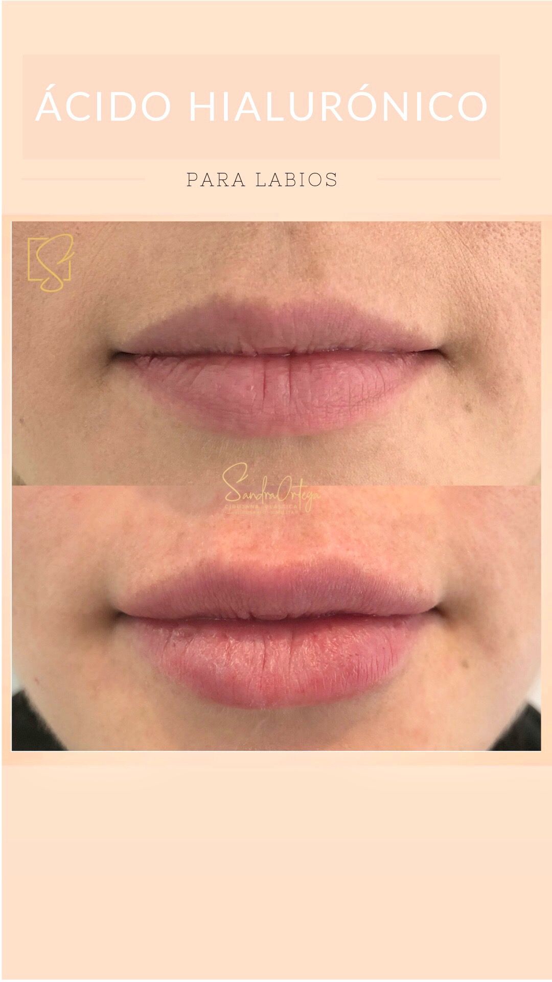 Sandra Viviana Ortega Trejos-35