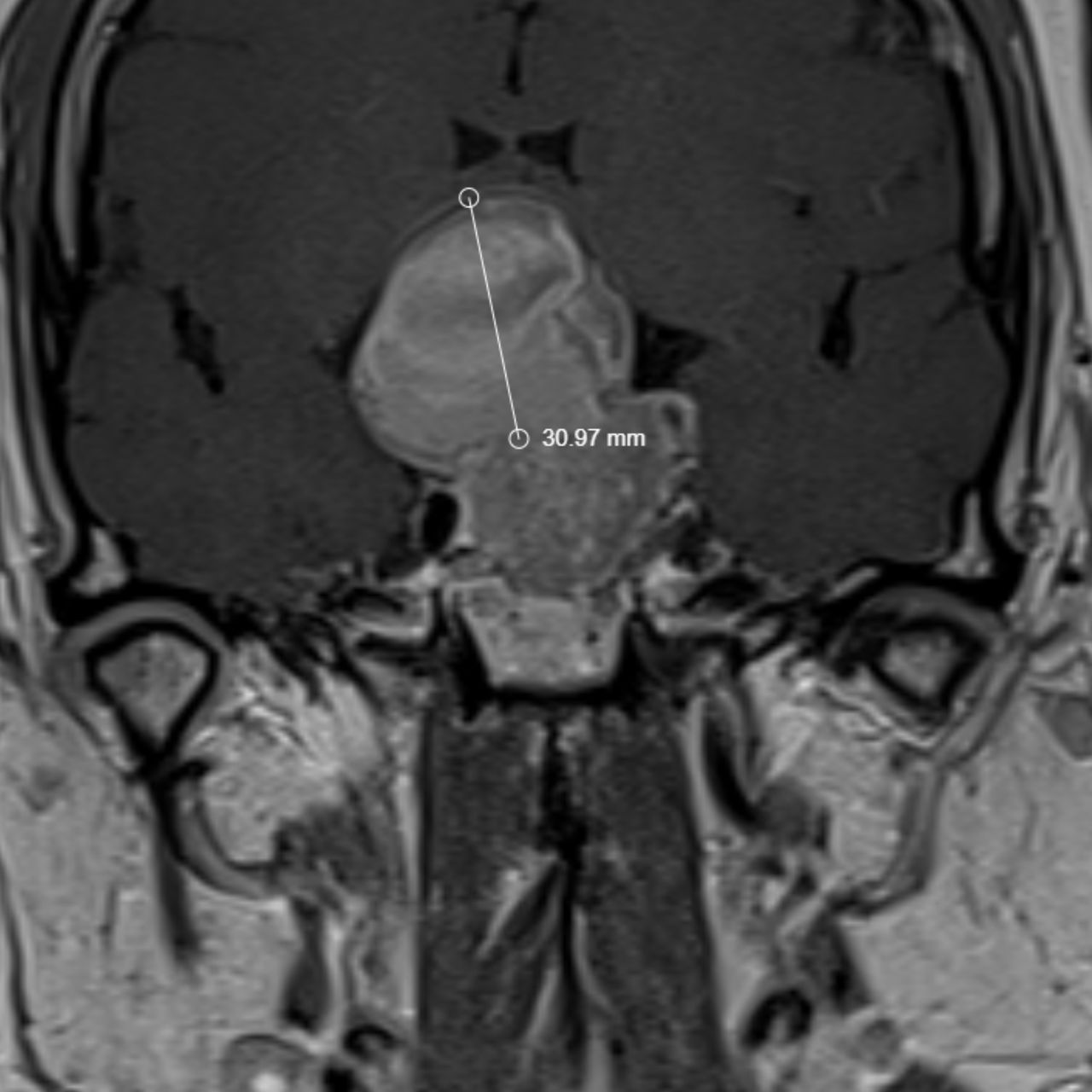 David Tafur Muñoz-1587