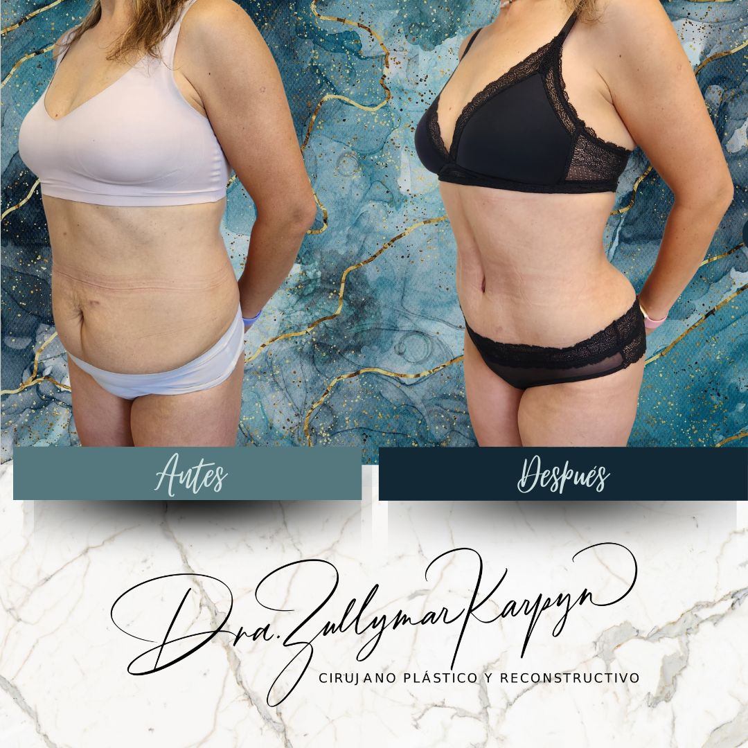 Zullymar Karpyn Brito-1