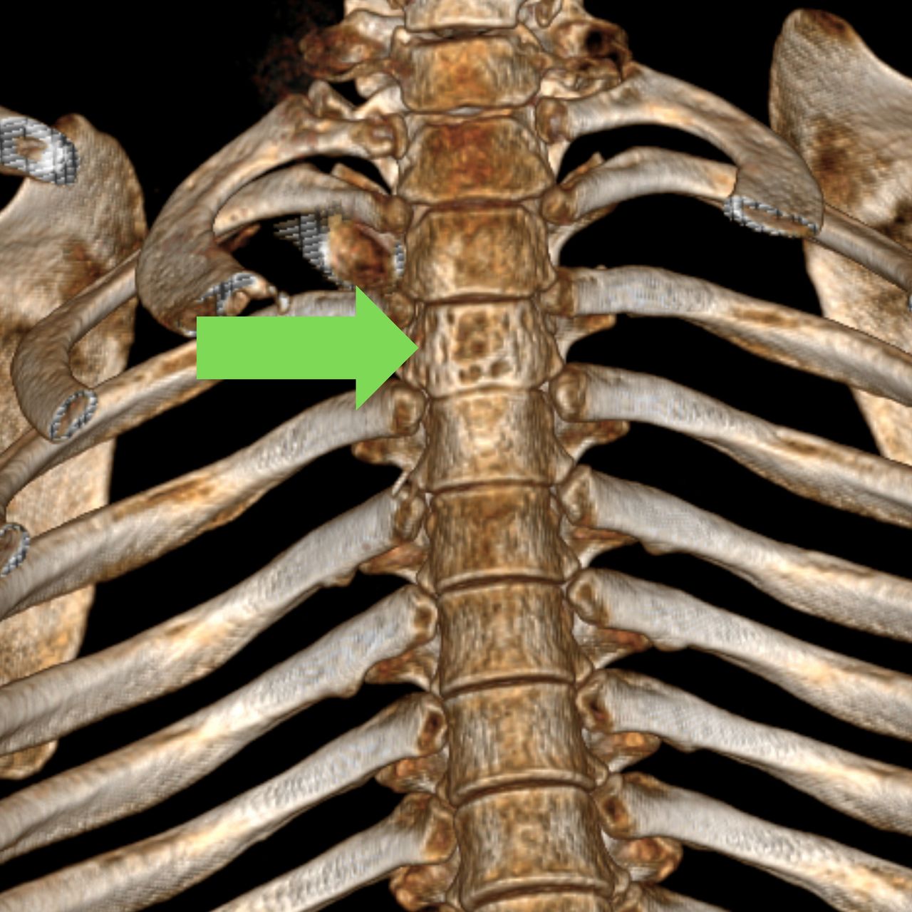 David Tafur Muñoz-2488