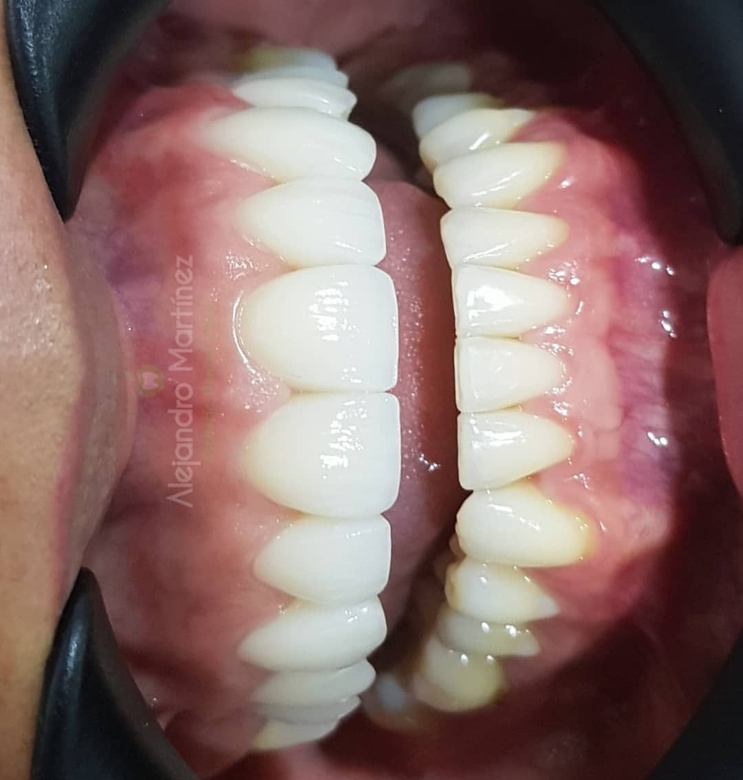 Alejandro Martinez-18