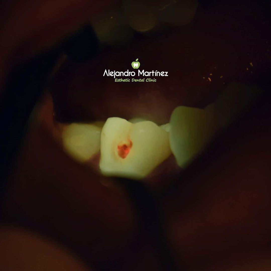 Alejandro Martinez-6