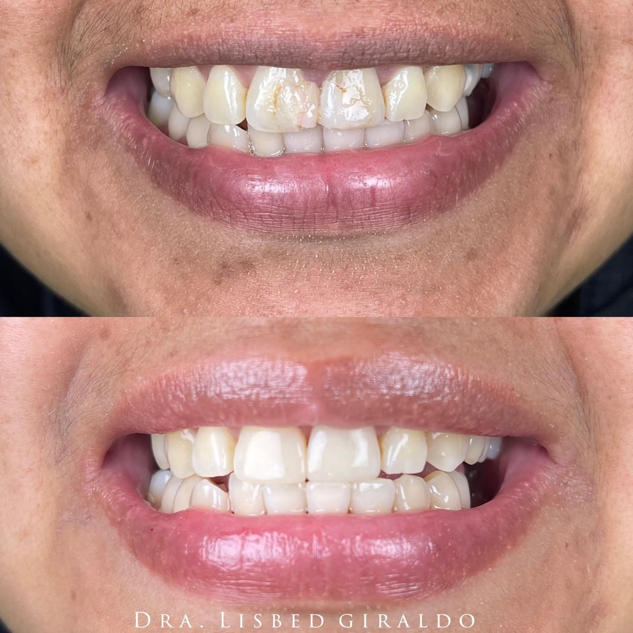 Lisbed Giraldo Olarte-22