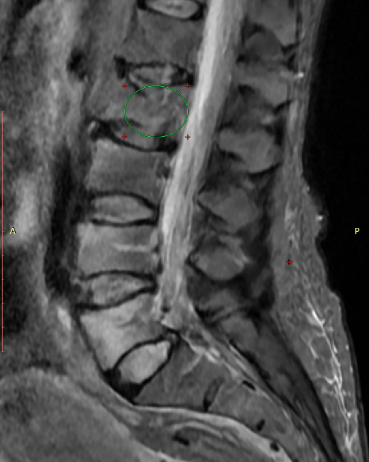 David Tafur Muñoz-2127