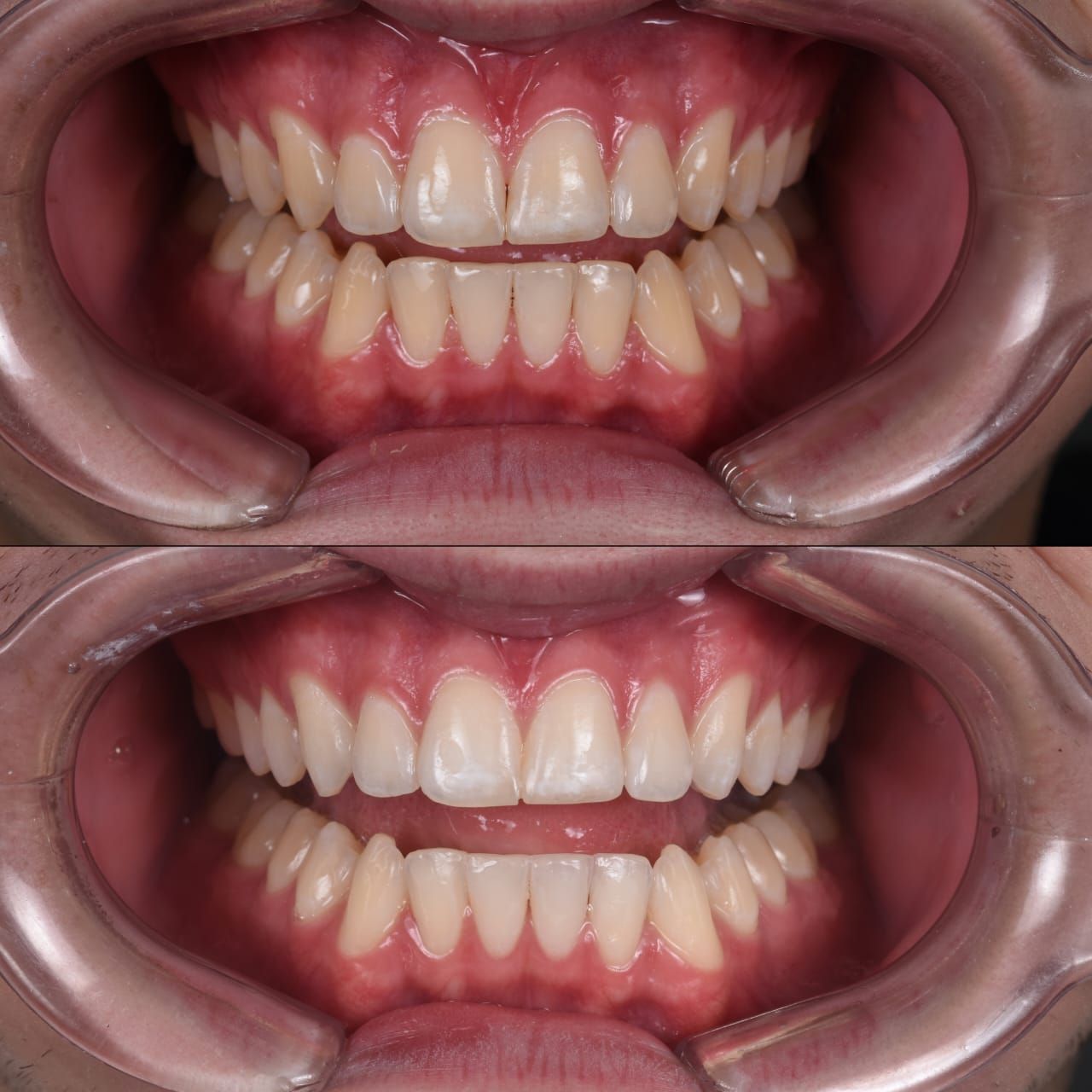 Sharon Andrea Waldo Nicholls-9