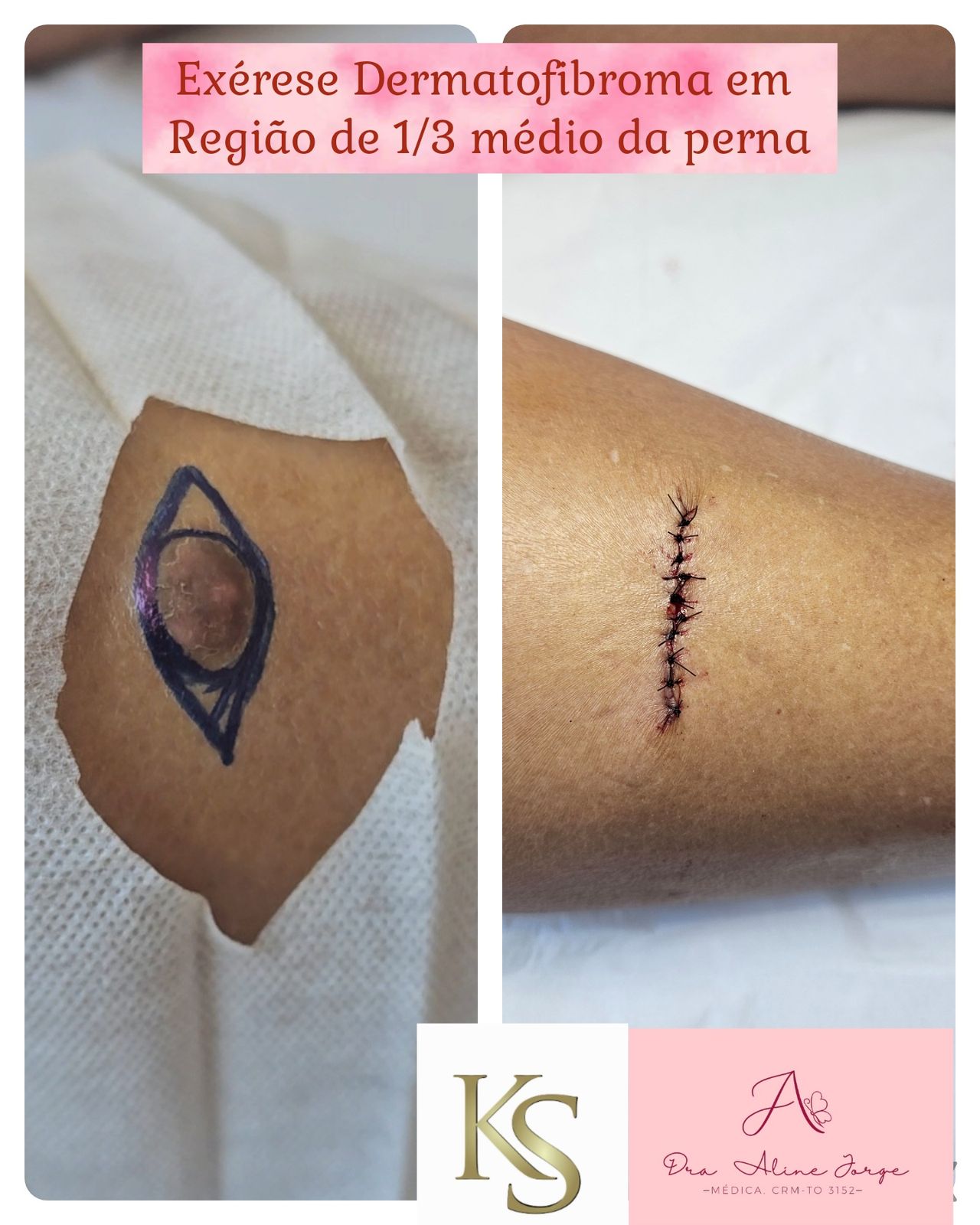 Aline Sousa Jorge-7