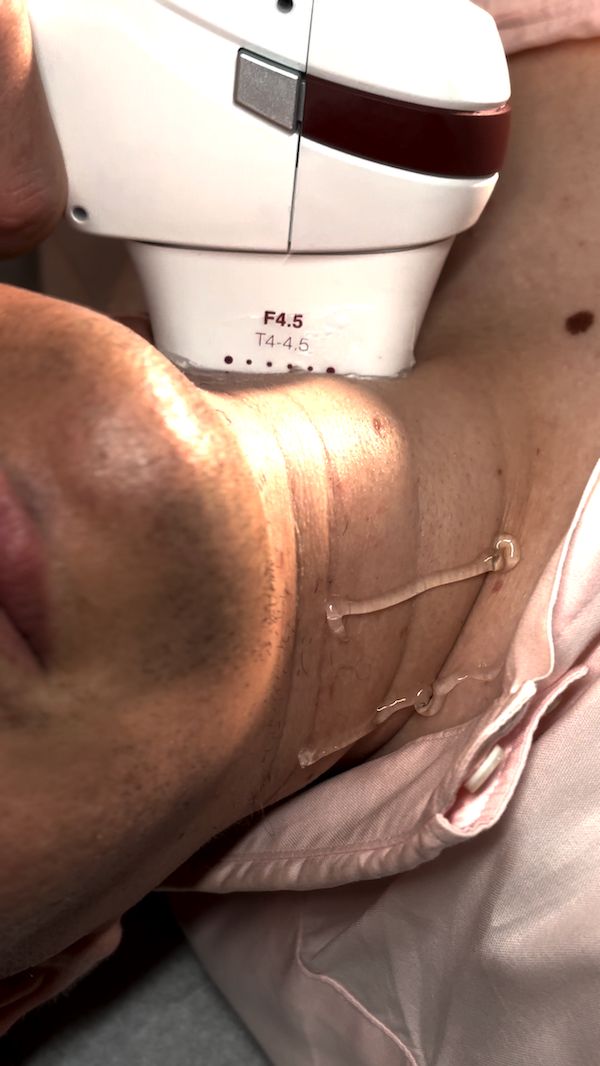 Andre Lins De Medeiros .-5