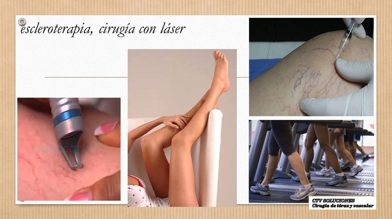 Walter Rodolfo Calle Mendoza-11