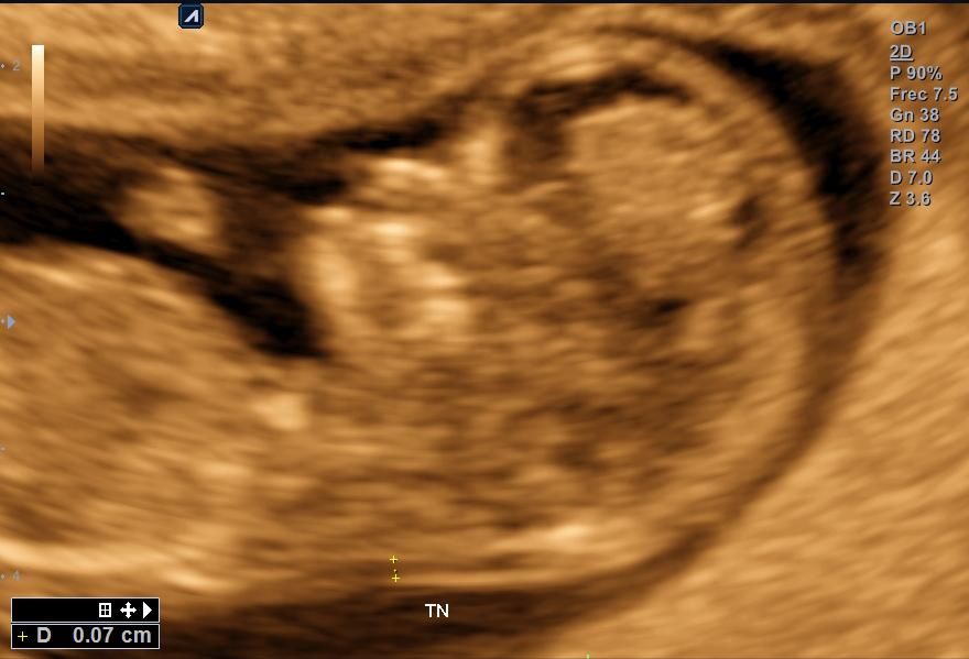 Benjamín Villarroel Castillo-3