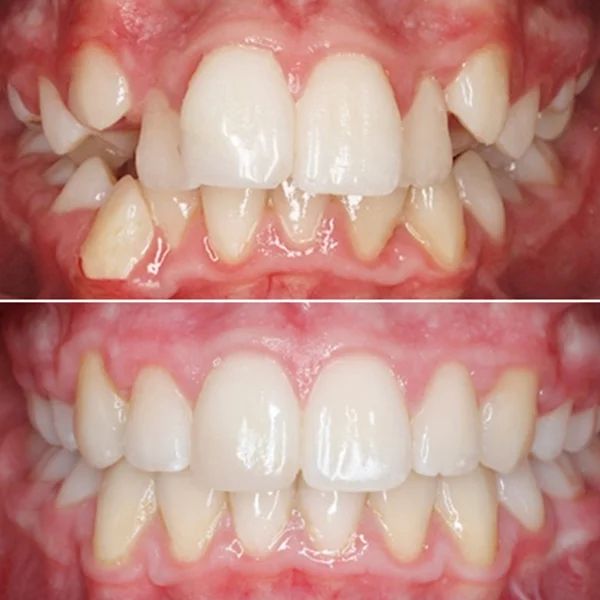 Frank Mendoza Alanya-31