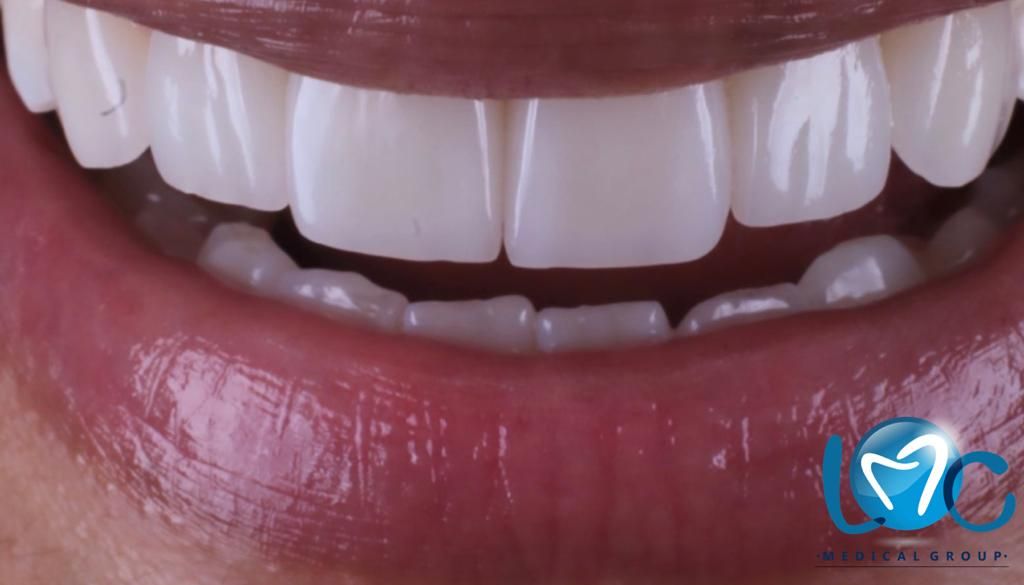 Lina Maria Cataño Restrepo-1