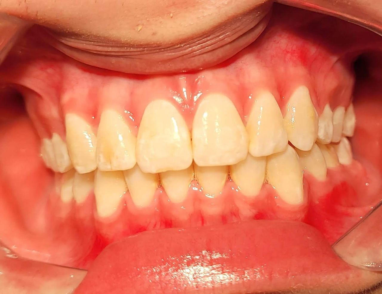 Tarianne Cristina Alves Aguiar-1