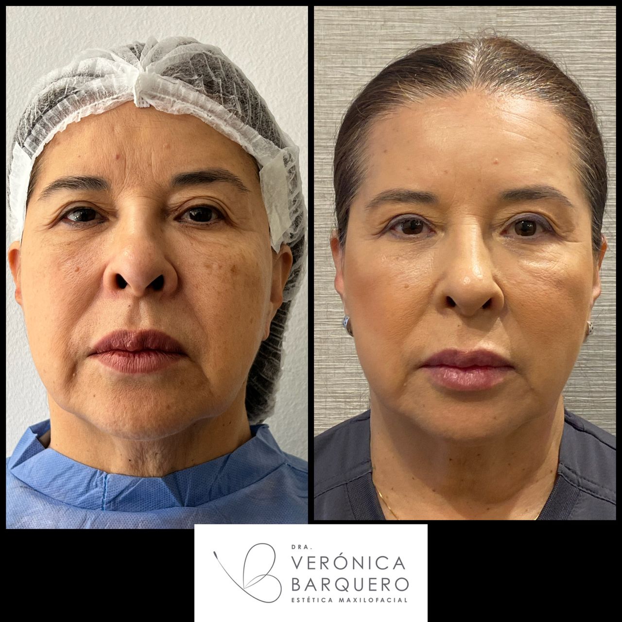 Veronica Maria Barquero Figueroa-6