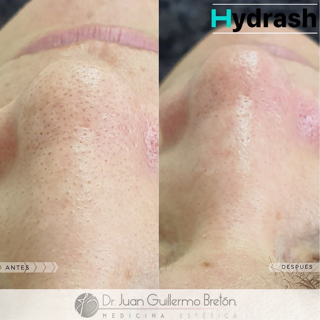 Juan Guillermo Bretón Franco-6