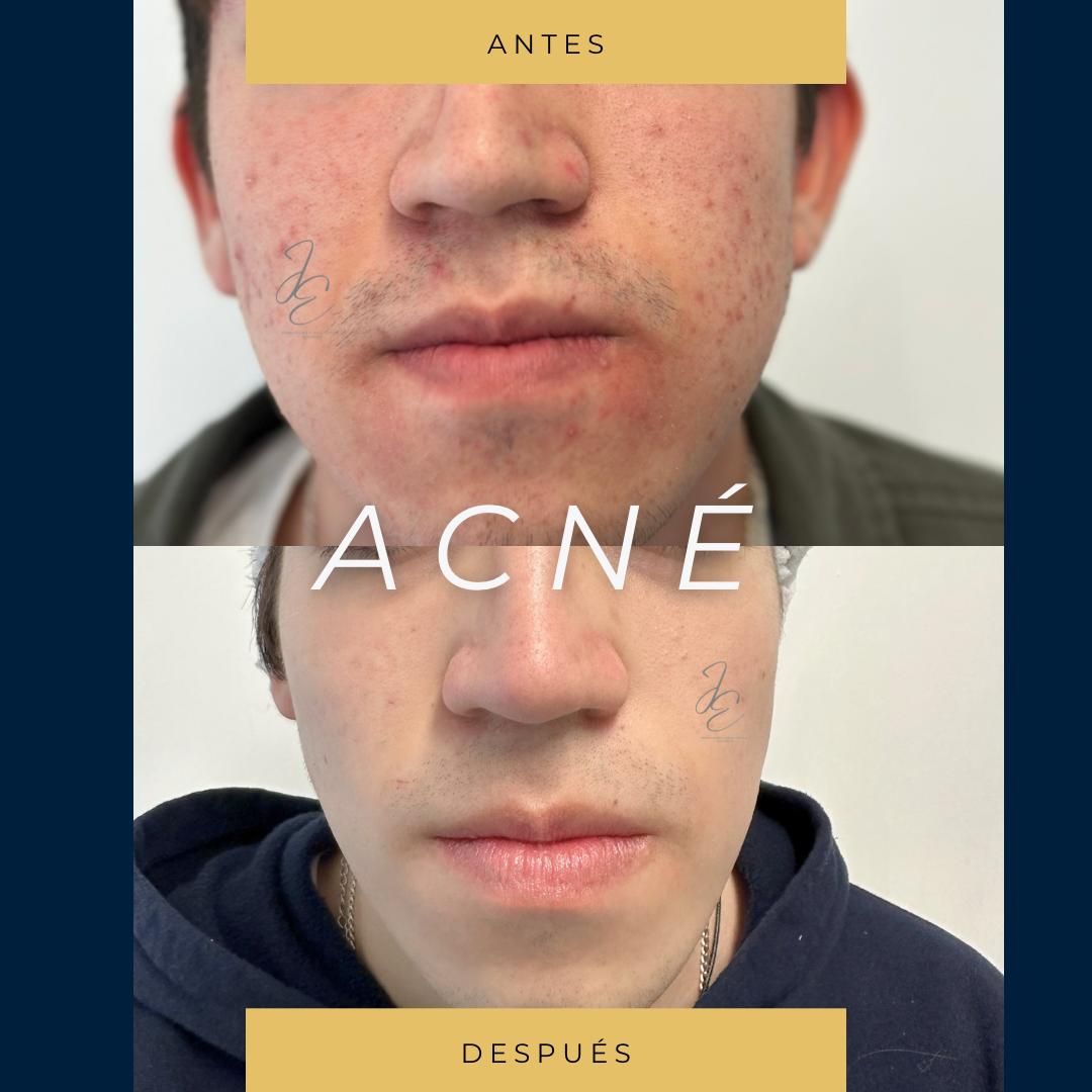 Jeanny Epieyu Diaz-4