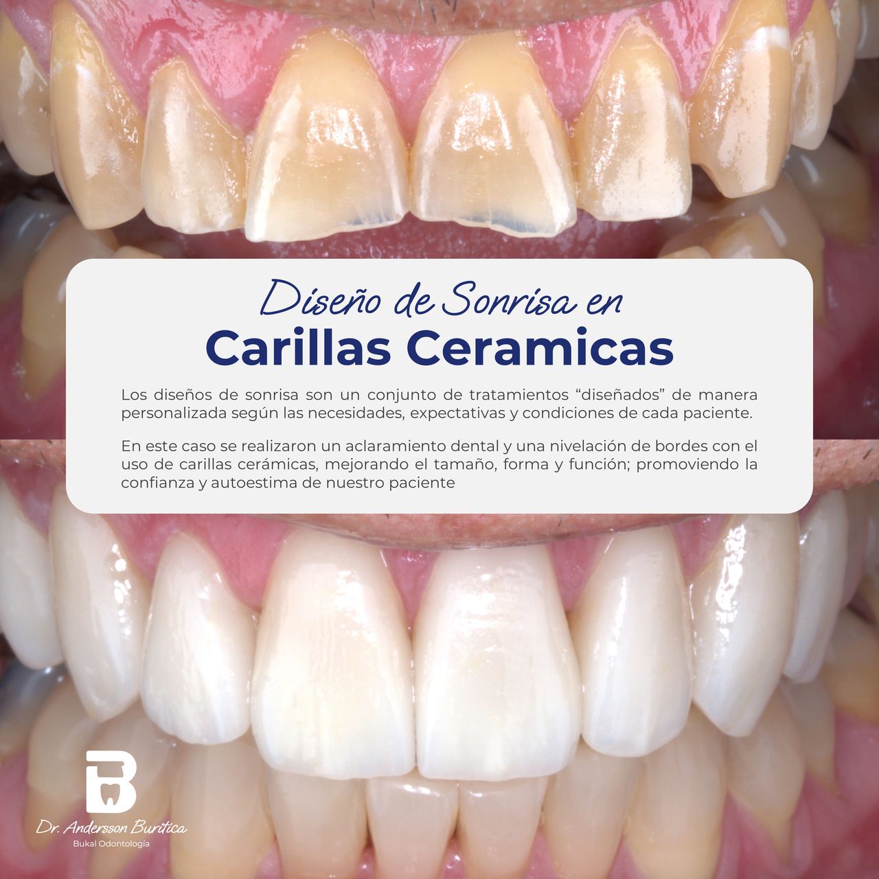 Andersson Buritica-6