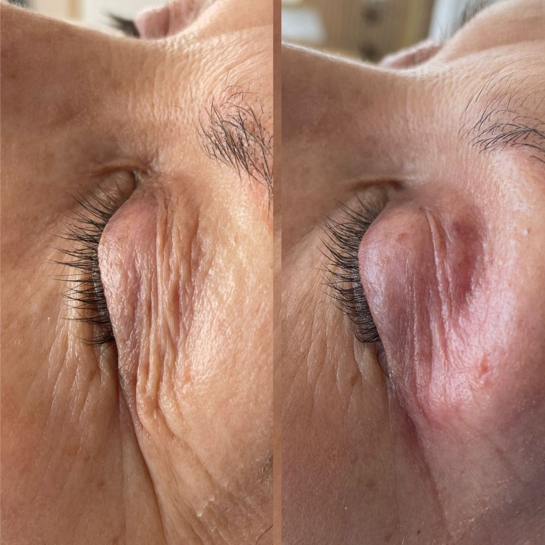 Scarlett Bartsch Ferrada-28