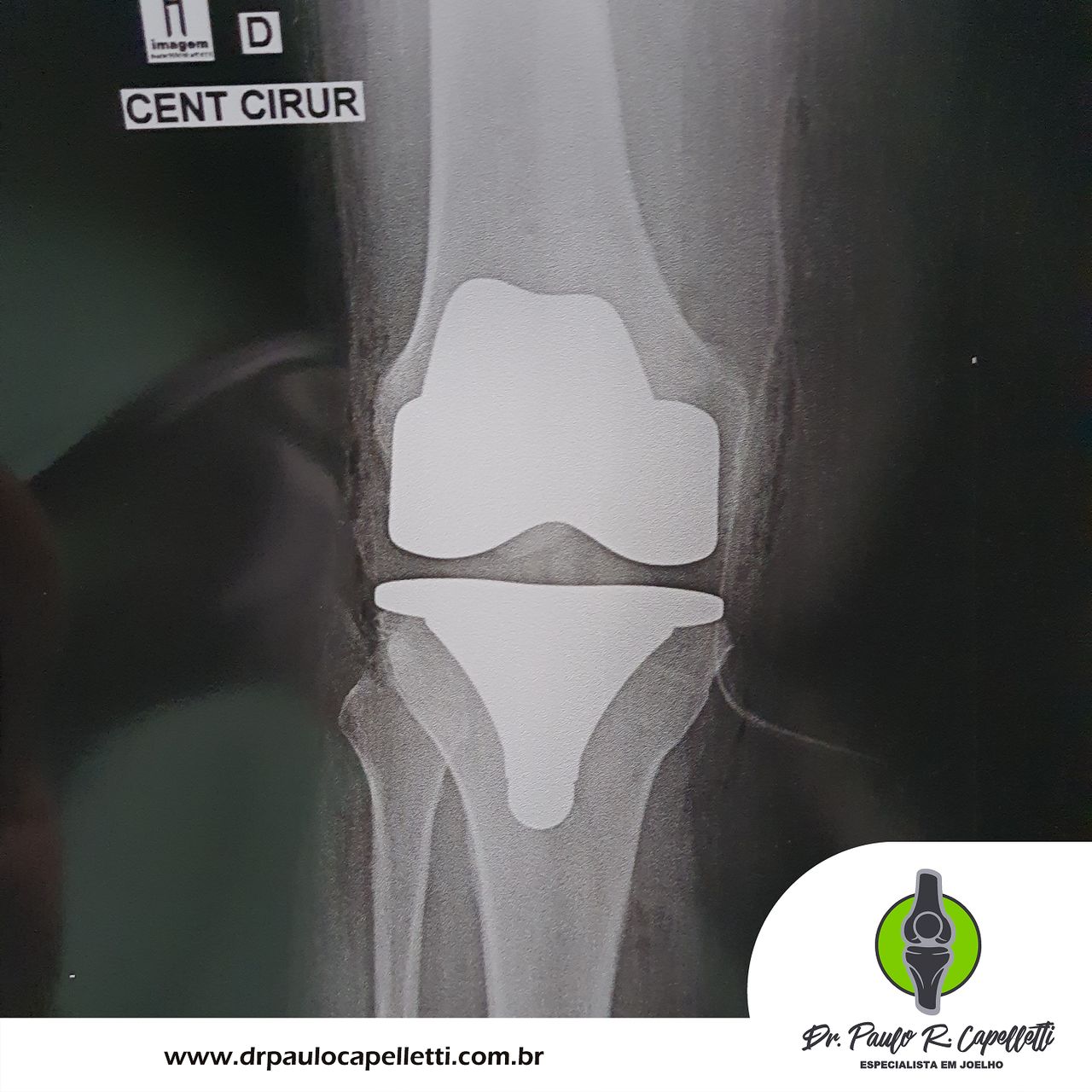 Paulo Roberto Capelletti-19