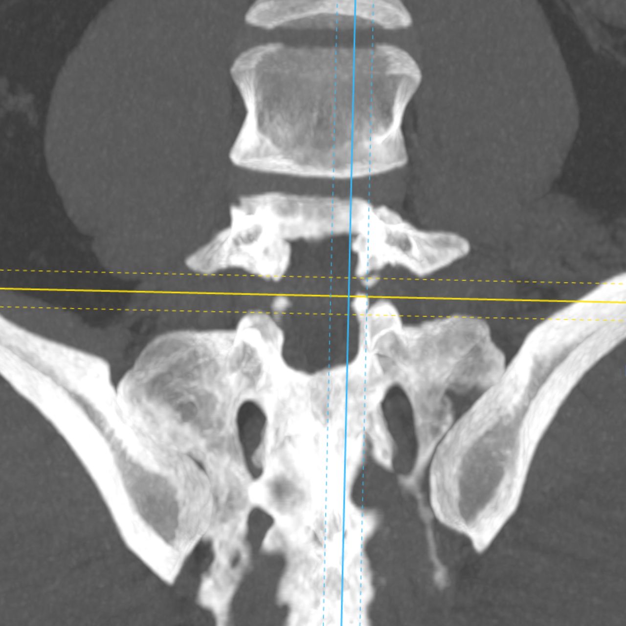 David Tafur Muñoz-2391