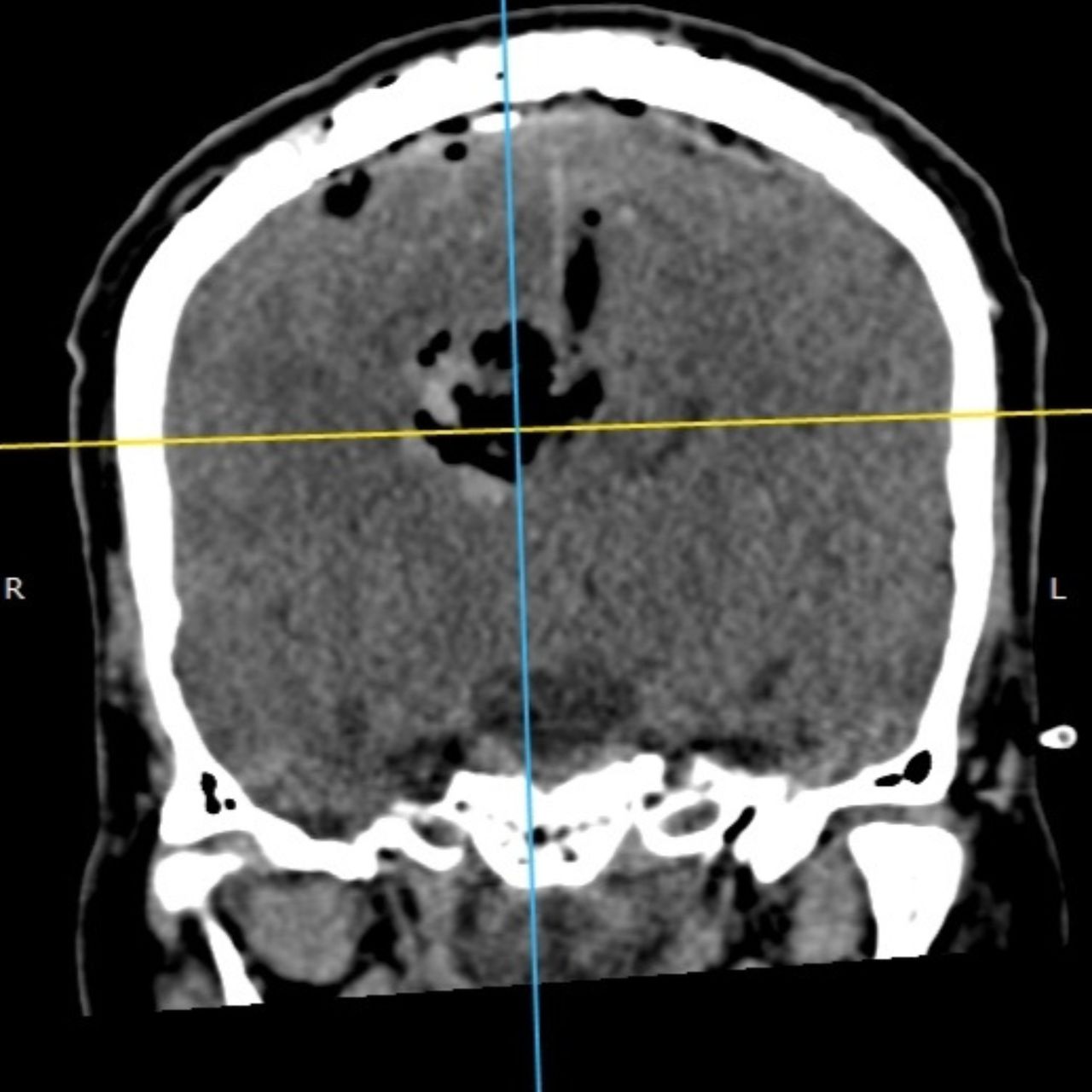 David Tafur Muñoz-2189