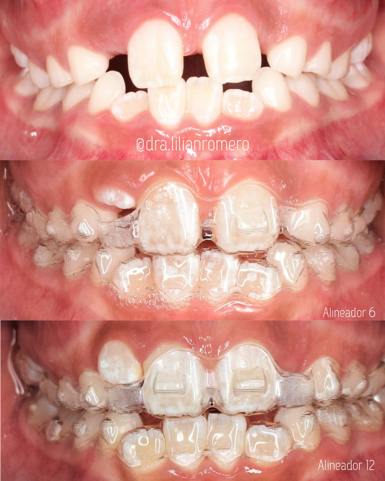 Lilian Catalina Romero Diaz-7