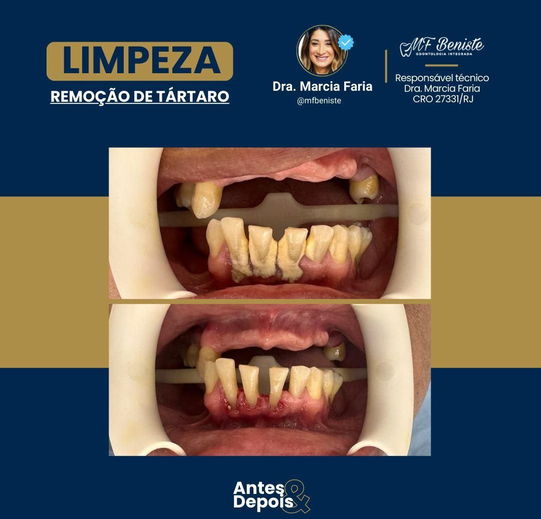 Marcia Faria Beniste-80