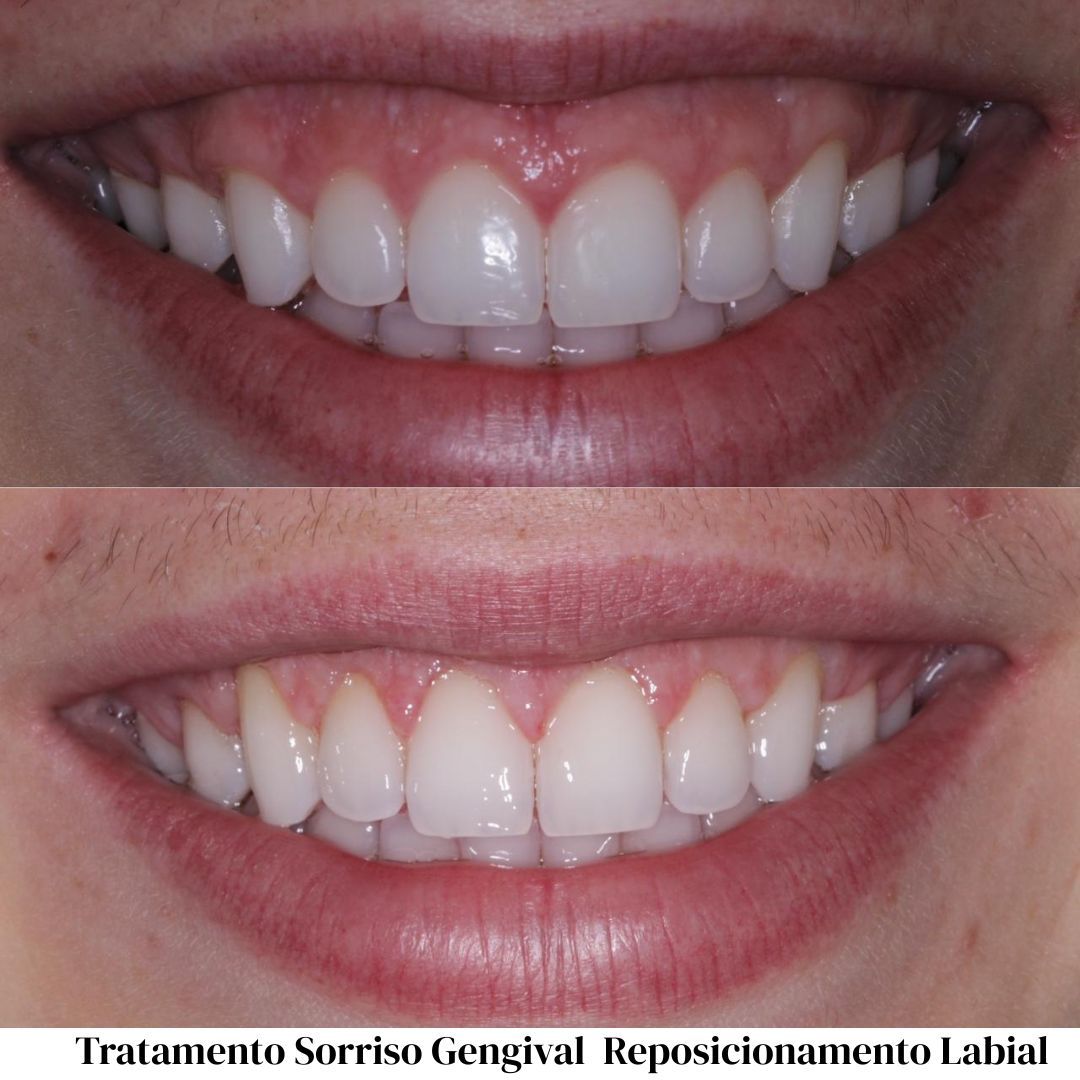 Gabriel Lucio Calazans Duarte-6