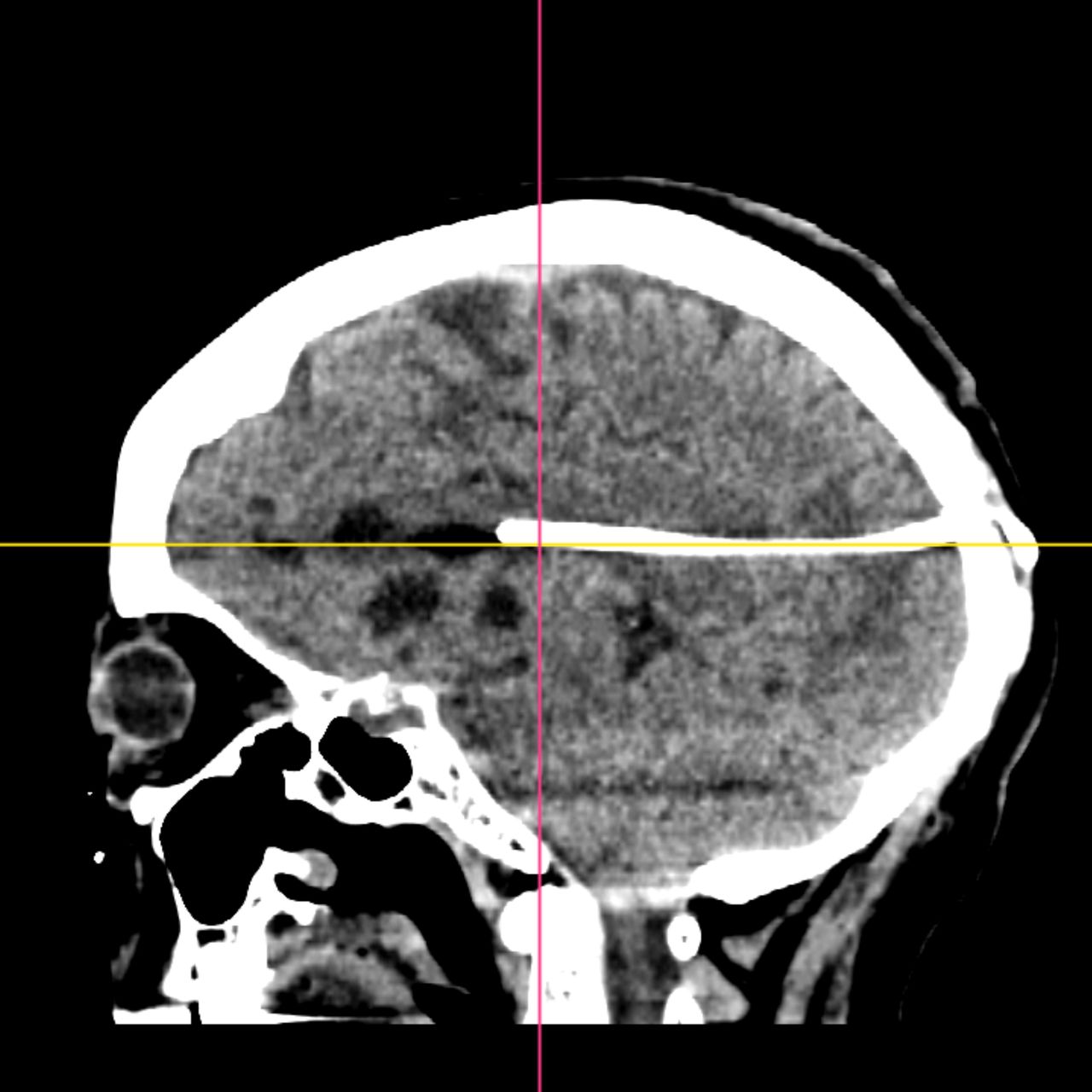 David Tafur Muñoz-2035