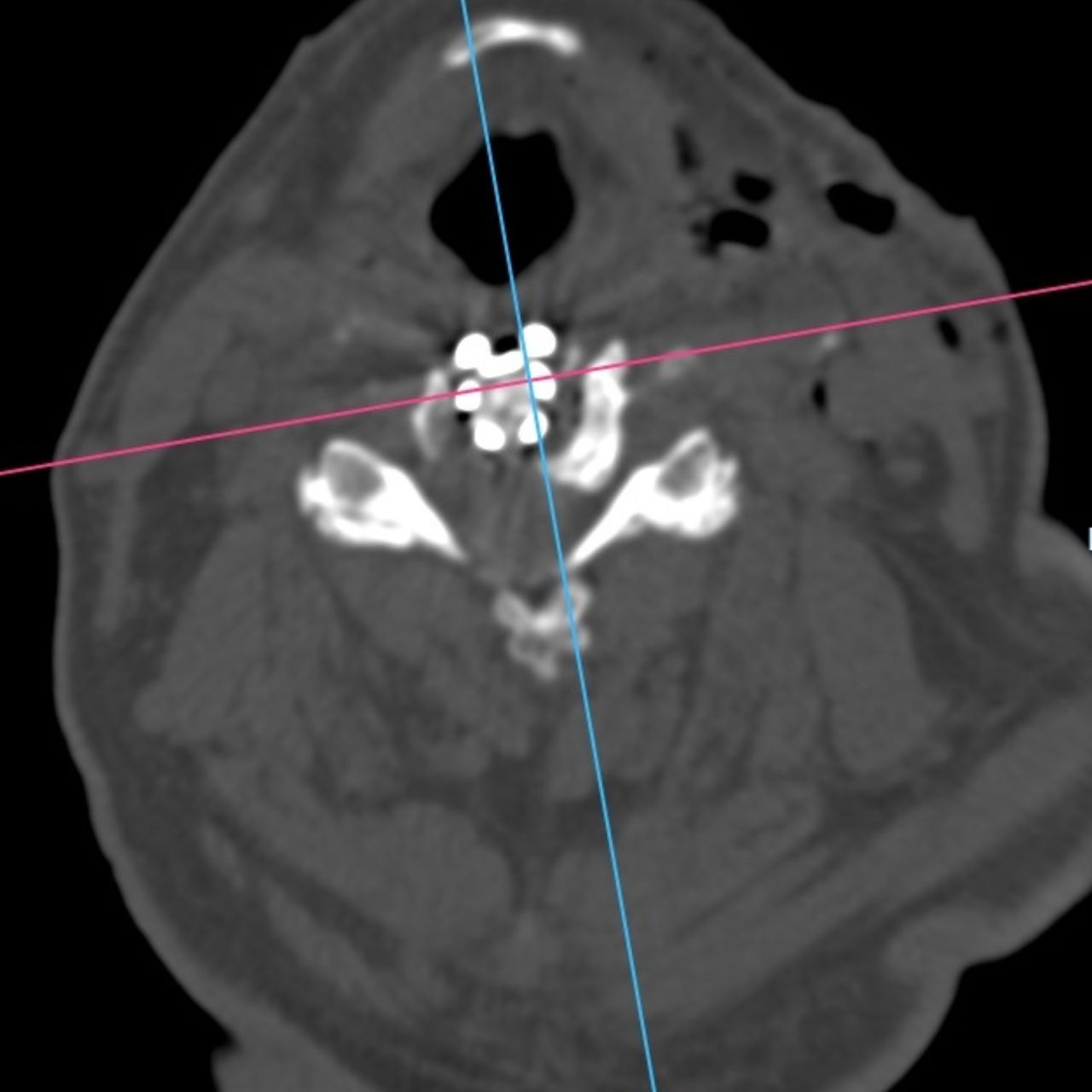 David Tafur Muñoz-1851