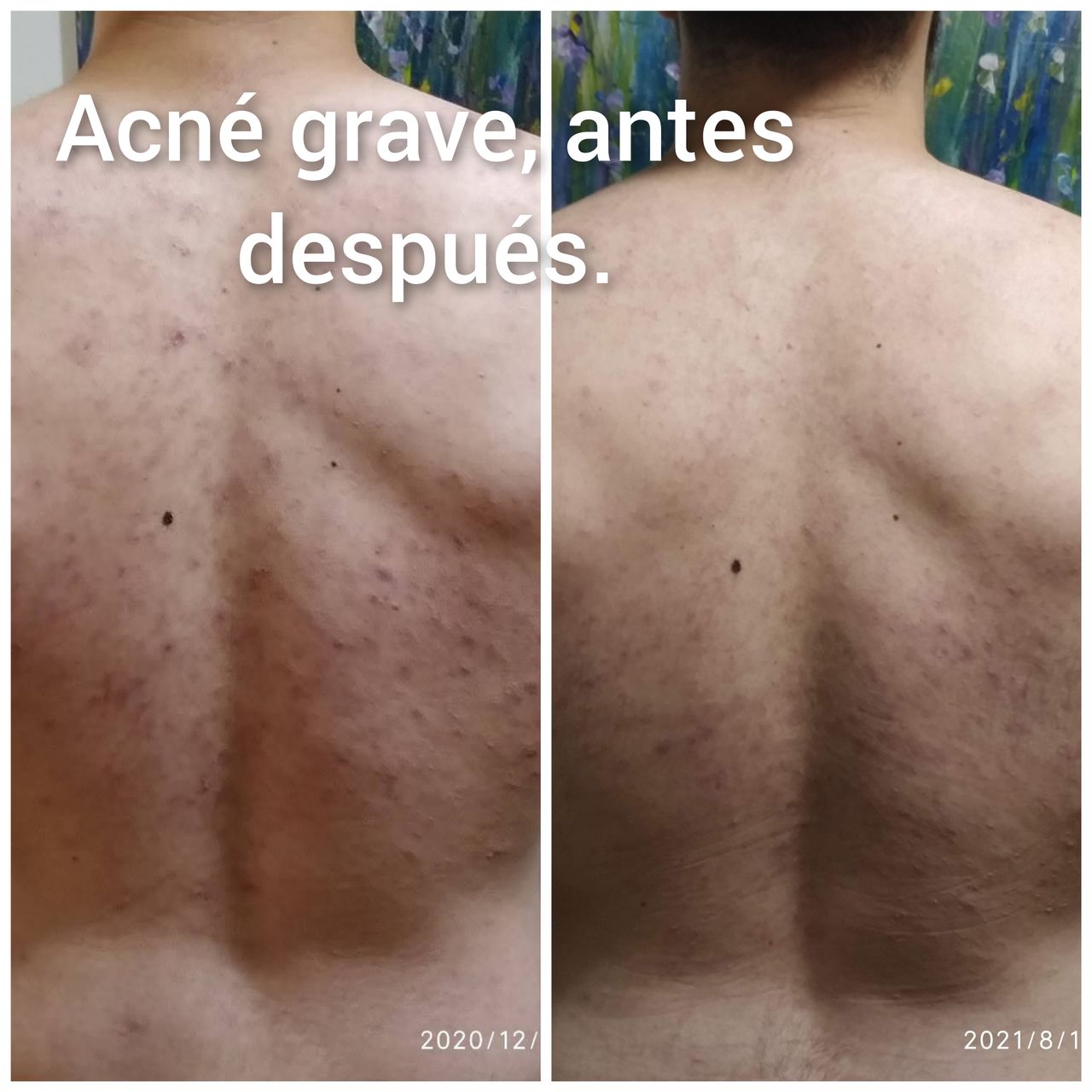 Alejandra Meijide-23