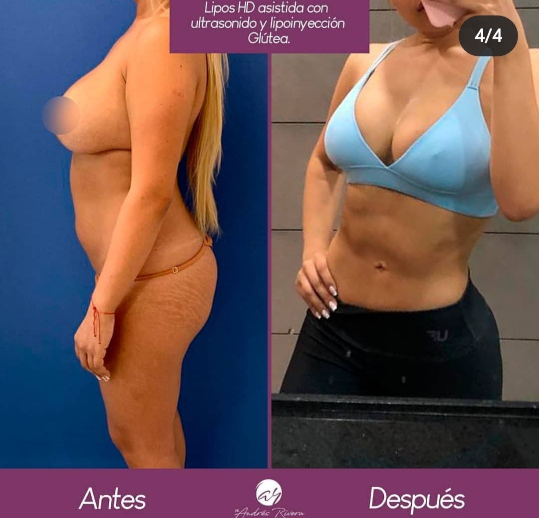 Andrés Rivera López-16