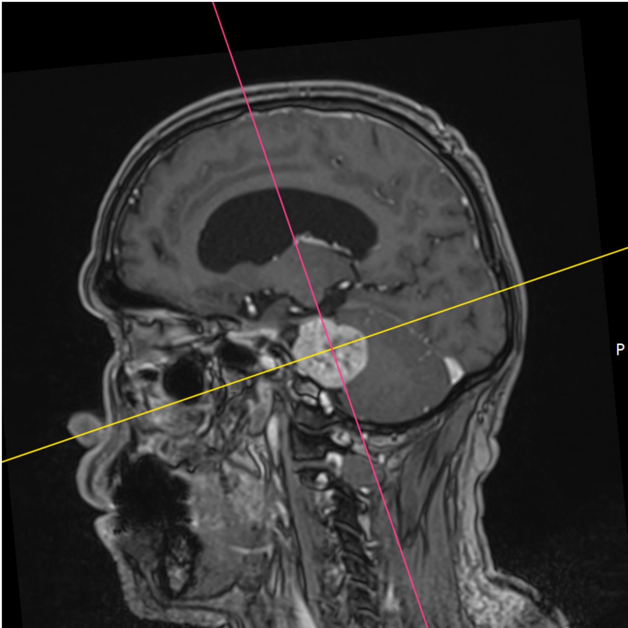 David Tafur Muñoz-1626