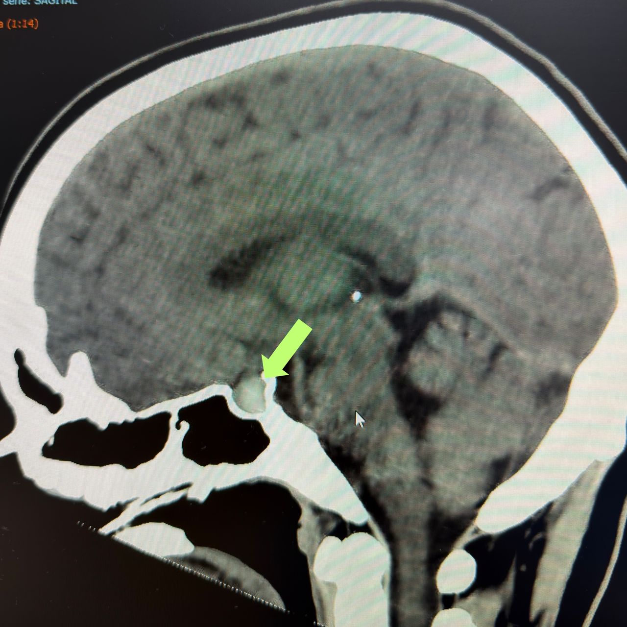 David Tafur Muñoz-2375