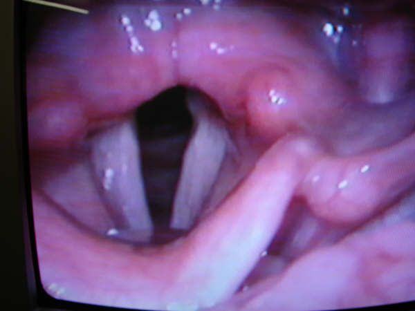 Waldyr Cavalcanti Junior-28