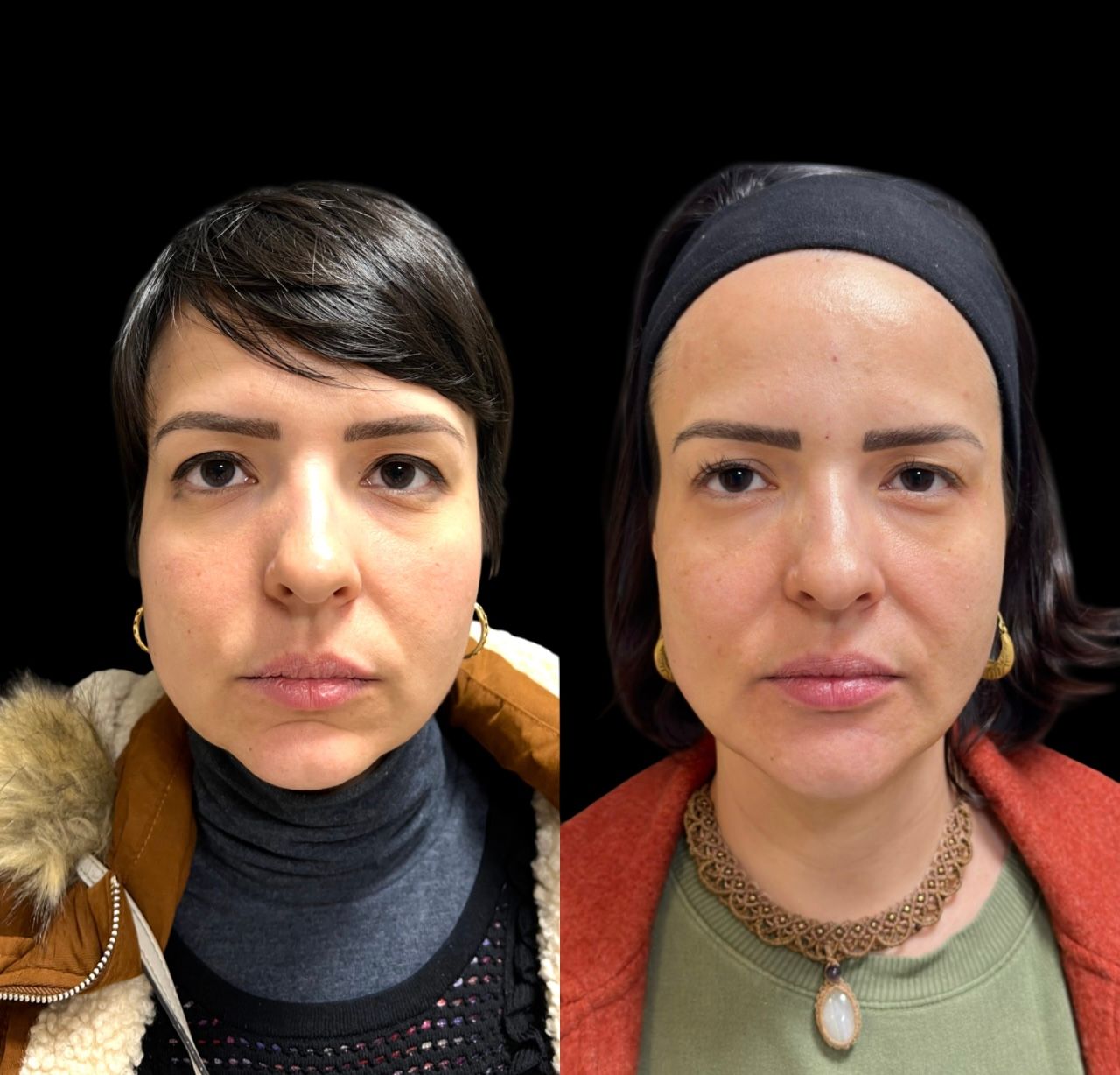 Caroline Benedeti-48