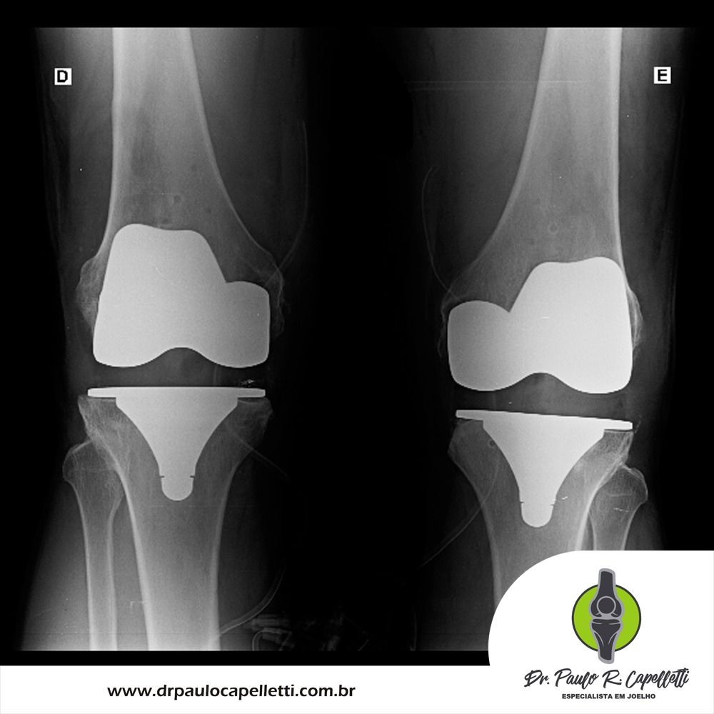 Paulo Roberto Capelletti-75