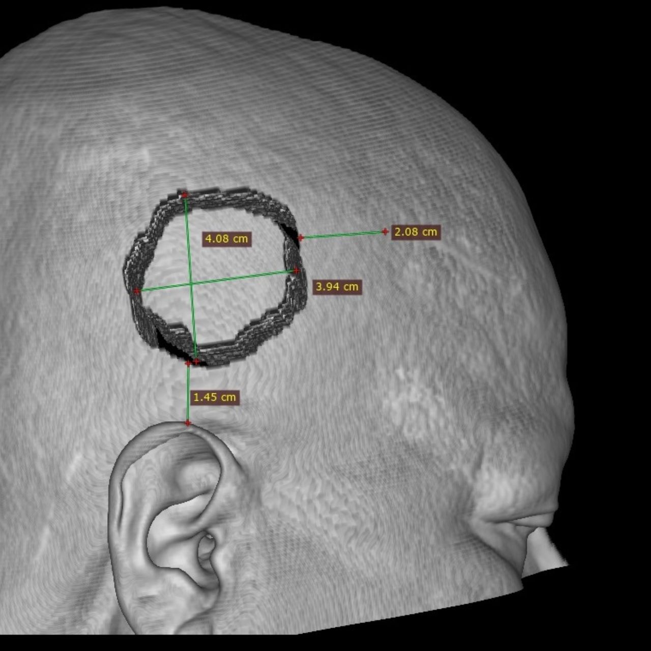 David Tafur Muñoz-1366