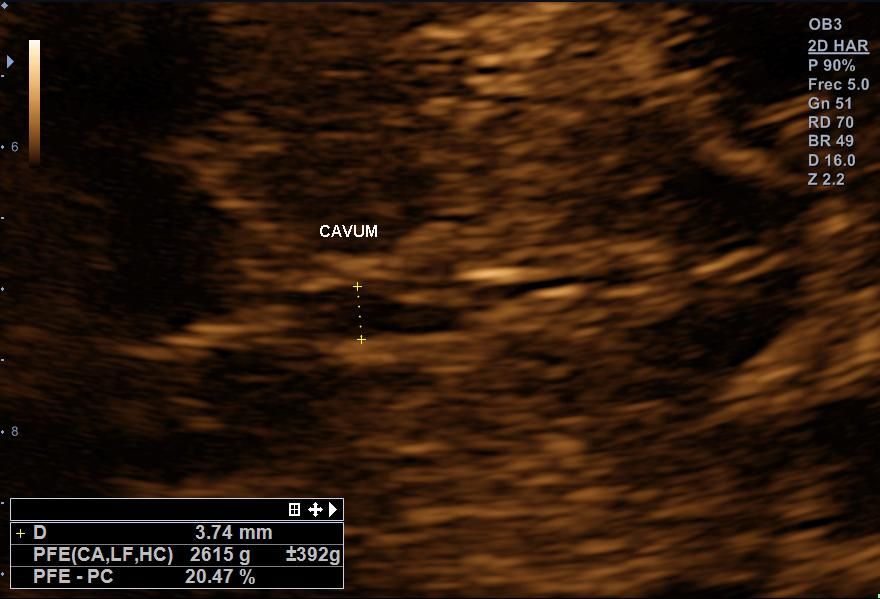 Benjamín Villarroel Castillo-9