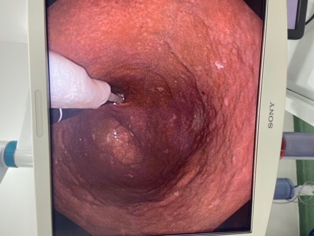 Guilherme Amadeu Poleto-53