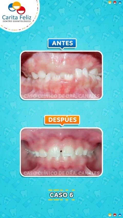 Angela Canales Larrea-5