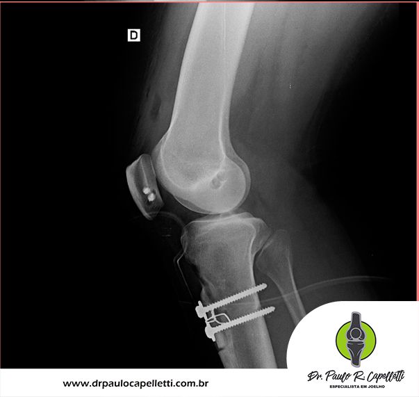 Paulo Roberto Capelletti-48