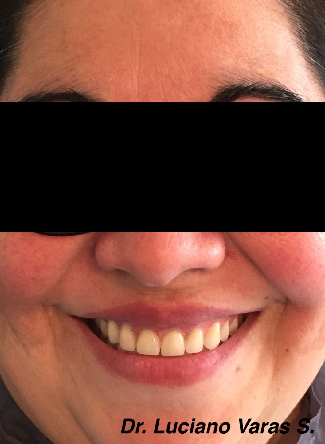 Luciano Varas Salinas-19