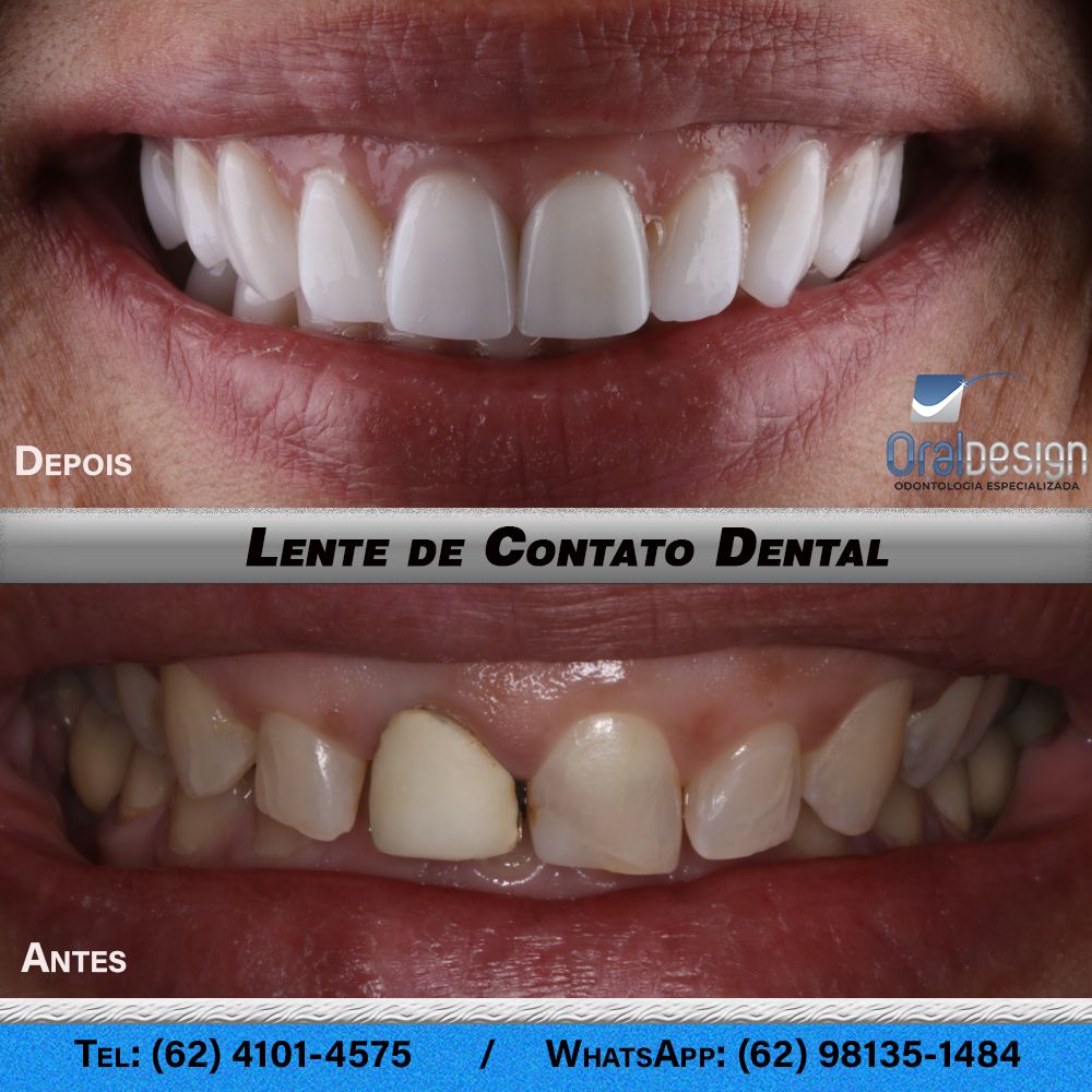 Danilo Monteiro Rezende Pereira-19